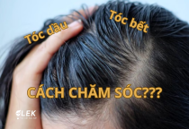 Cách Chăm Sóc Tóc Dầu Cho Nam Giới Hiệu Quả Vào Mùa Hè